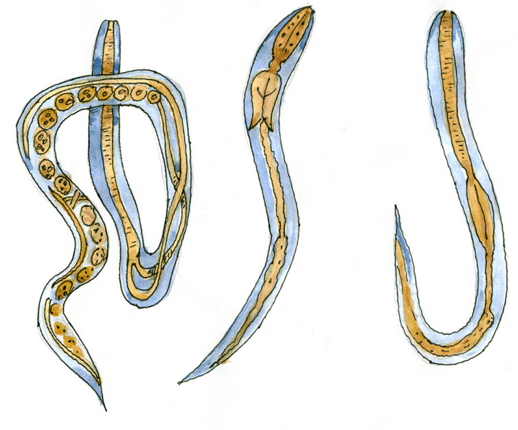 Intestine