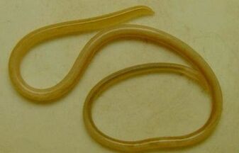 Types of parasites in the human body